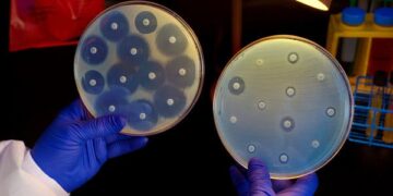 Superbacterias y agro: qué nos enseña la ciencia argentina para enfrentar la resistencia microbiana